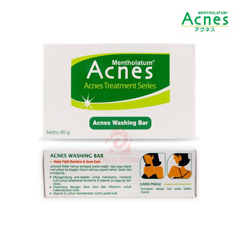 ACNES Washing Bar 80gr (Sabun Batang)